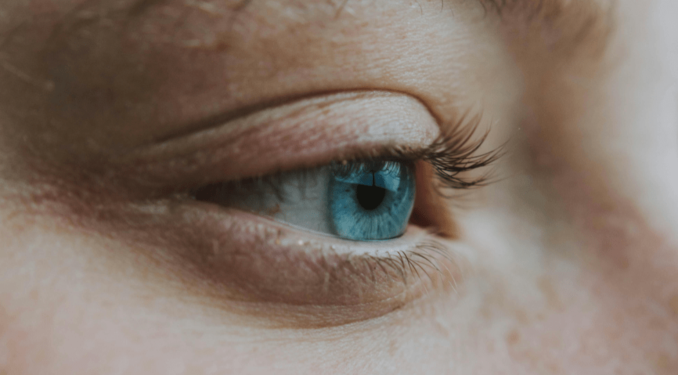 What Is Commonly Misdiagnosed As Pink Eye